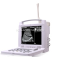 Laptop Portable Ultrasound Scanner Harga Mesin Ultrasound